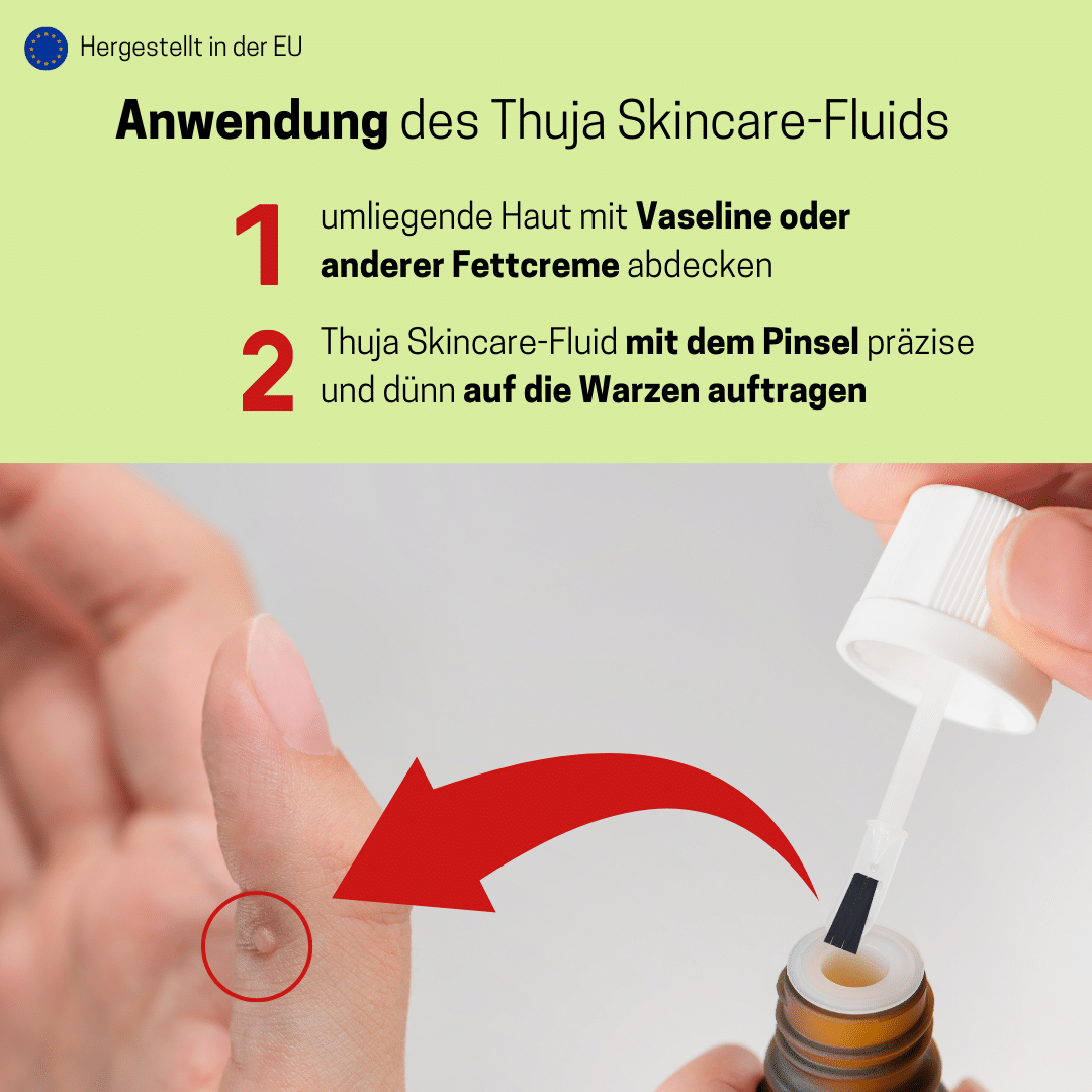 Detailansicht Medosan Skare Fluid Warzenentferner